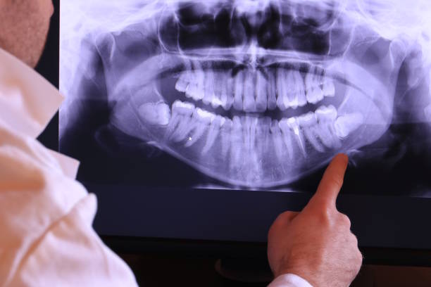 Best Emergency Denture Repair in Stonewall, MS