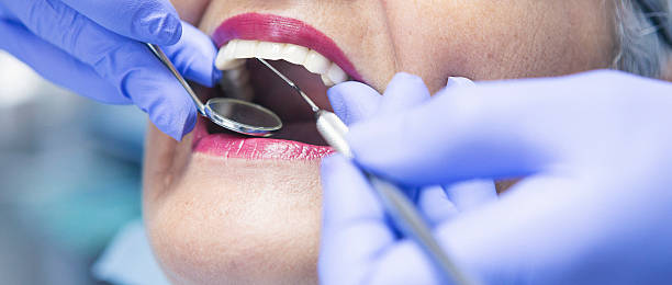 Best Urgent Care for Lost Fillings or Crowns in Stonewall, MS
